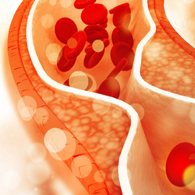 Sindrome metabolica in breve:
dalle cause alla prevenzione